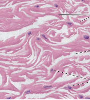 <p>what type of connective tissue is this?</p>