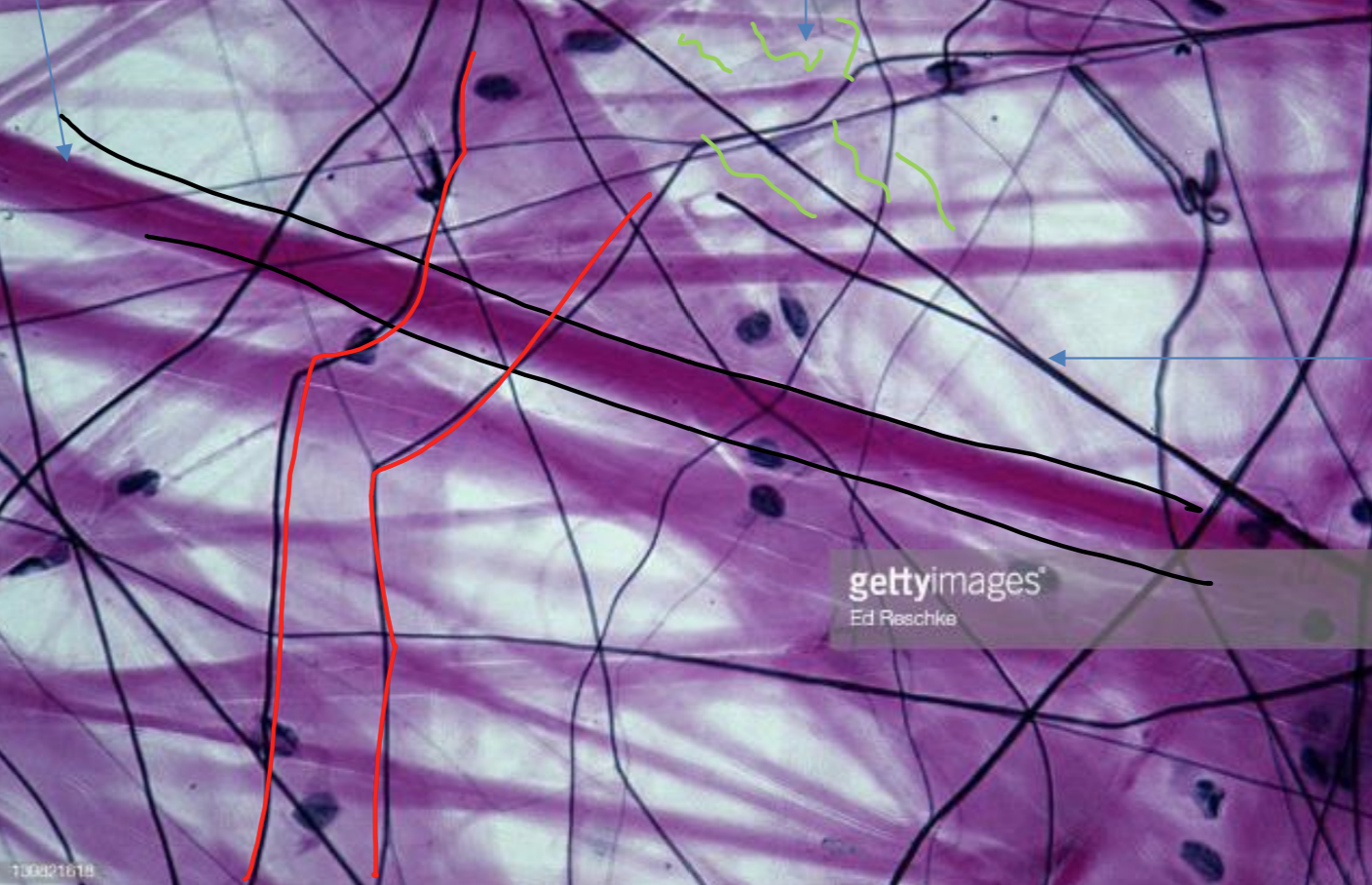 <p>what tissue is depicted in the image</p>