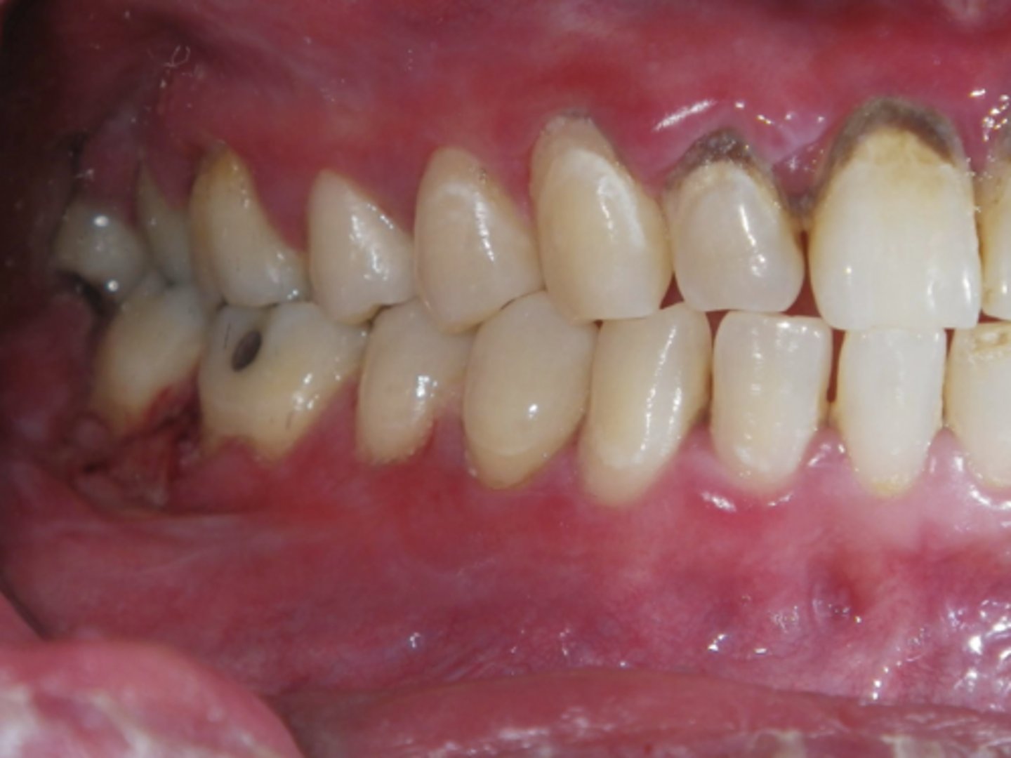 <p>What condition?</p>