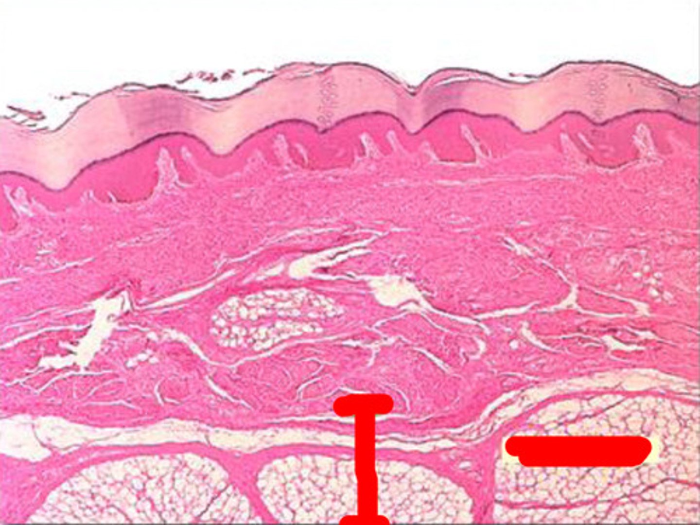 <p>What layer of skin is this?</p>