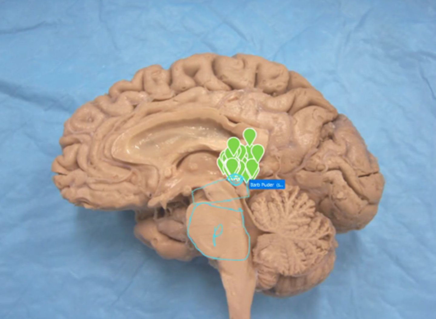 <p>Identify the structure labeled "P"</p>