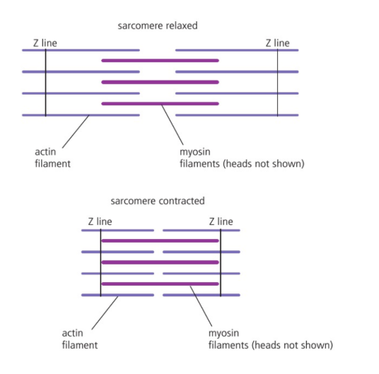 <p>Z lines in the contracted sarcomere are close together after contraction</p>