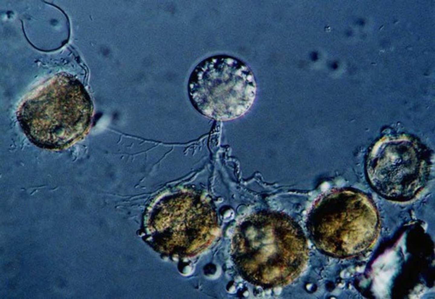 <p>aquatic and produce flagellated spores; they were the first fungi</p>