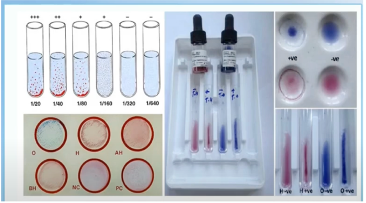 <p>Somatic Antigen</p>