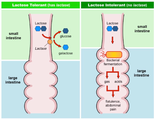 <p>lactose intolerance</p>