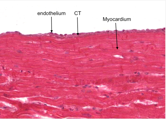 Endocardium