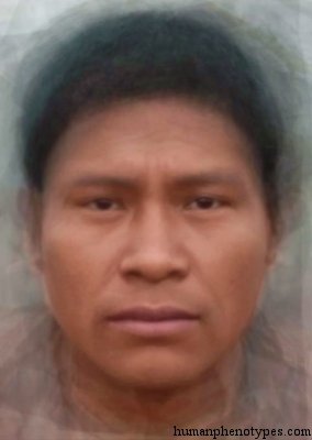 <p>Identify this Phenotype</p>