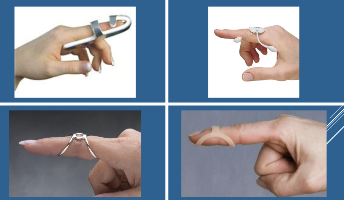 <p>position opposite of the deformity </p>