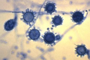 <p>Which sp is this? At what temperature?</p>