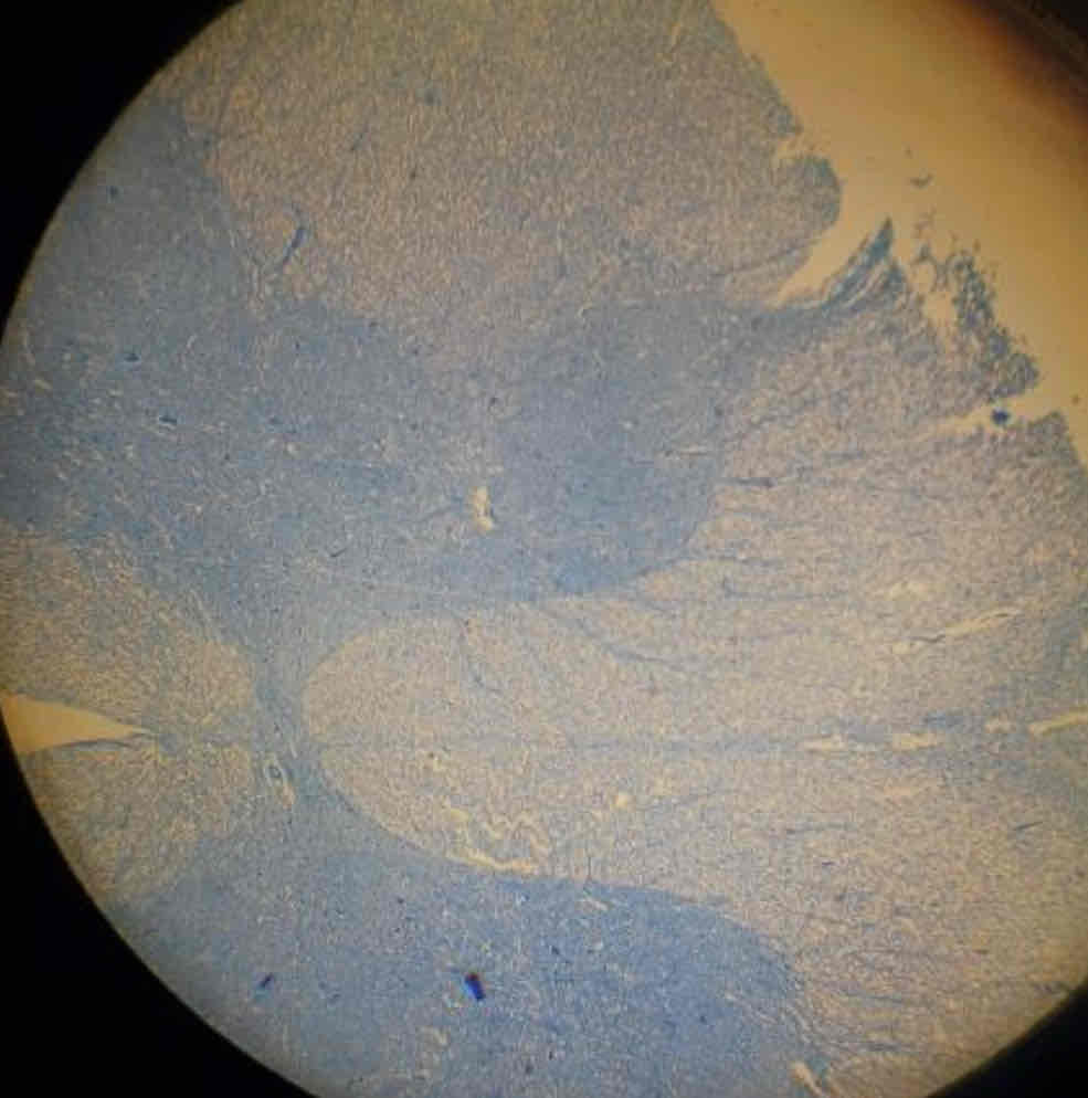 term image