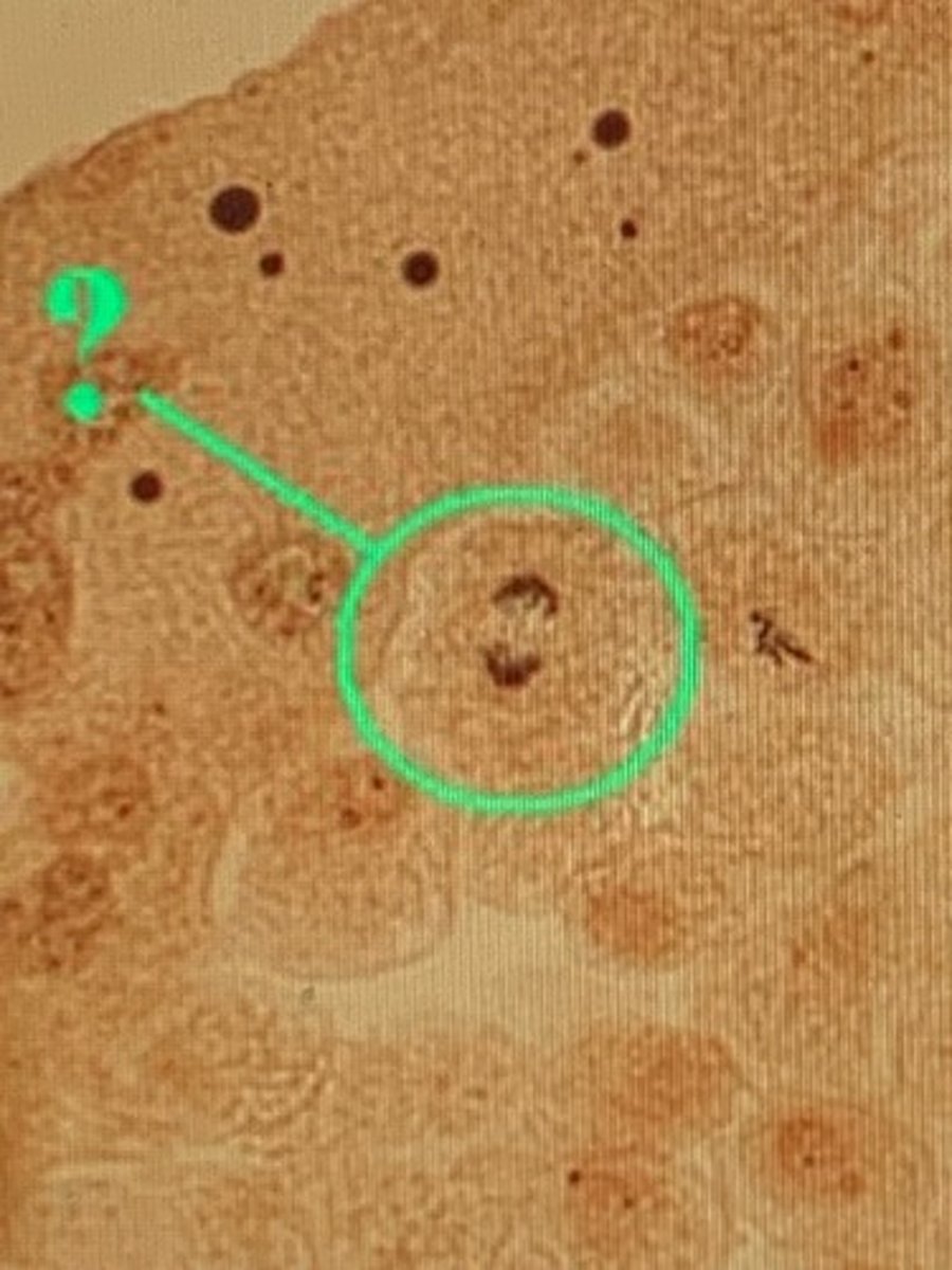 <p>anaphase</p>