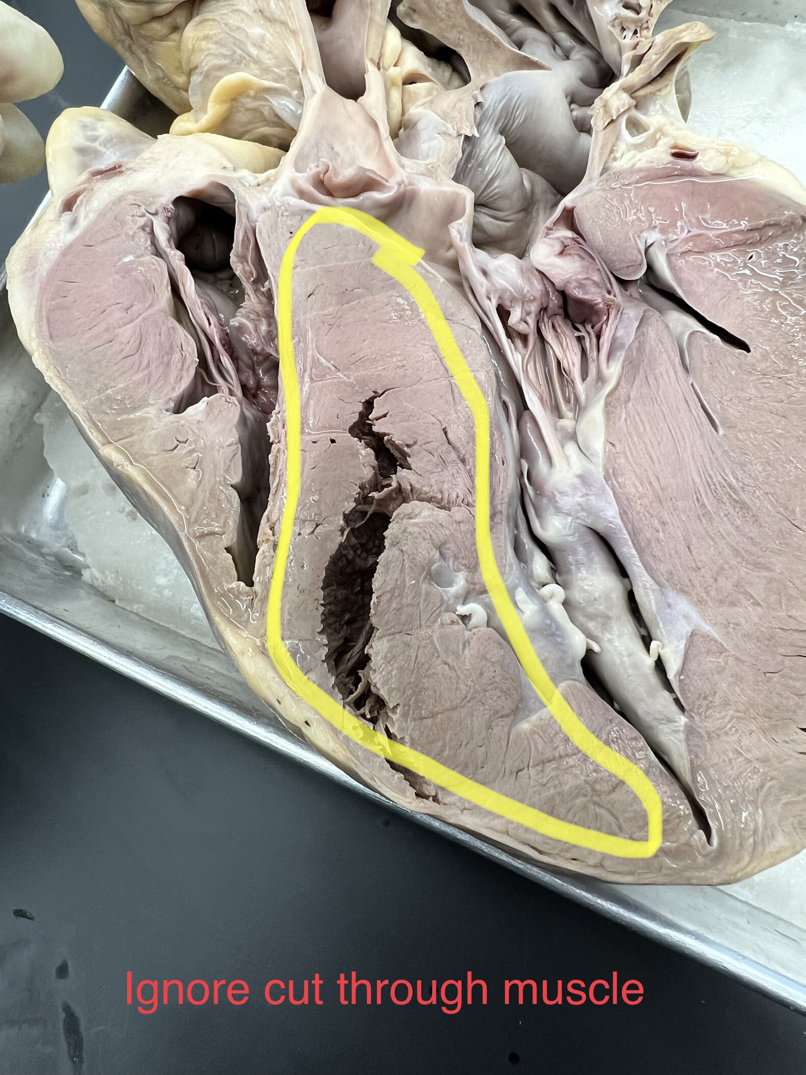 Name the heart structure.