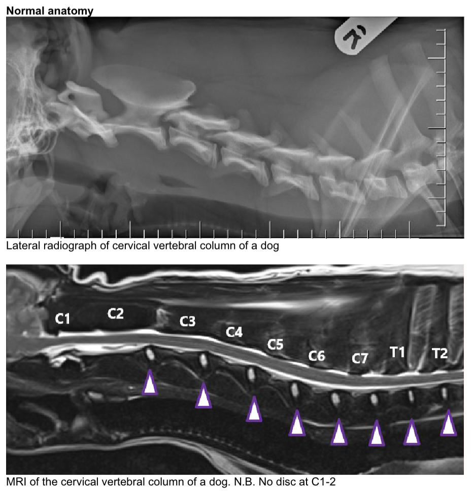 <p>IVDD— normal anat</p><p>is the lack of IVD in C1/C2 normal?</p>