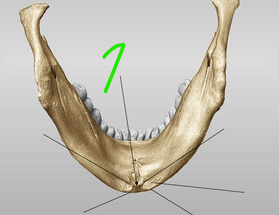 <p>1, =midden v binnenkant v corpus mandibulae </p>