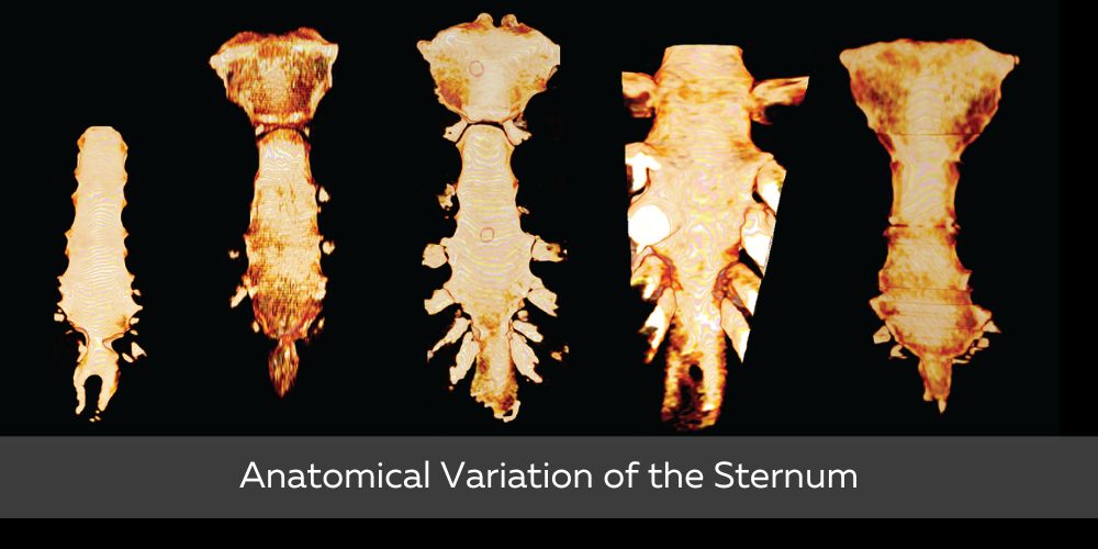 <p>Humans vary slightly in anatomy; most structures match textbook descriptions, with some deviations.</p>