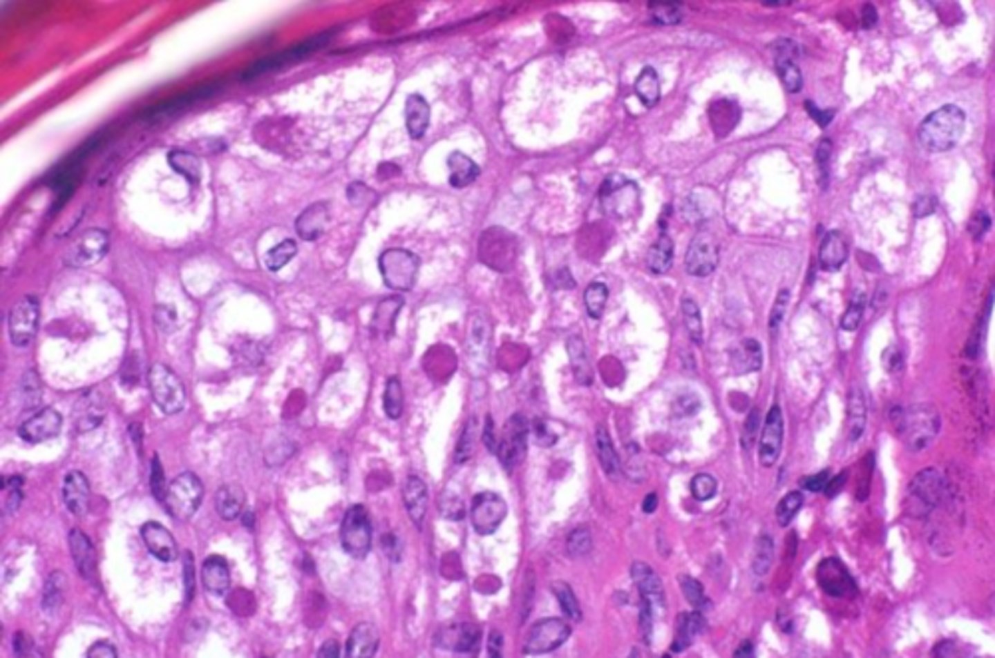 <p>which viral inclusion?</p>