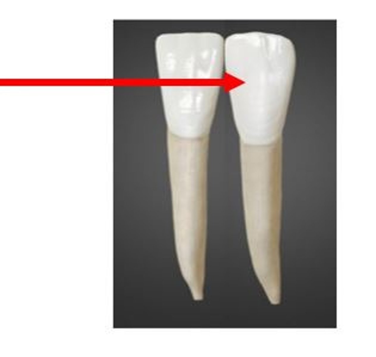 <p>What tooth is this?</p>