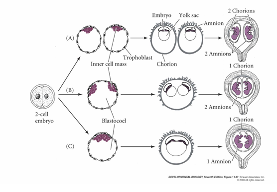 <p>2 chorions, 1 amnion</p>