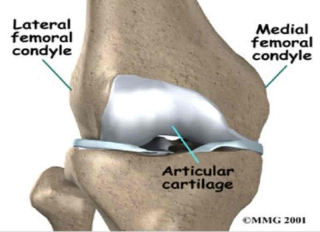 <p>cat #2 / rounded articular project / femoral condyle</p>