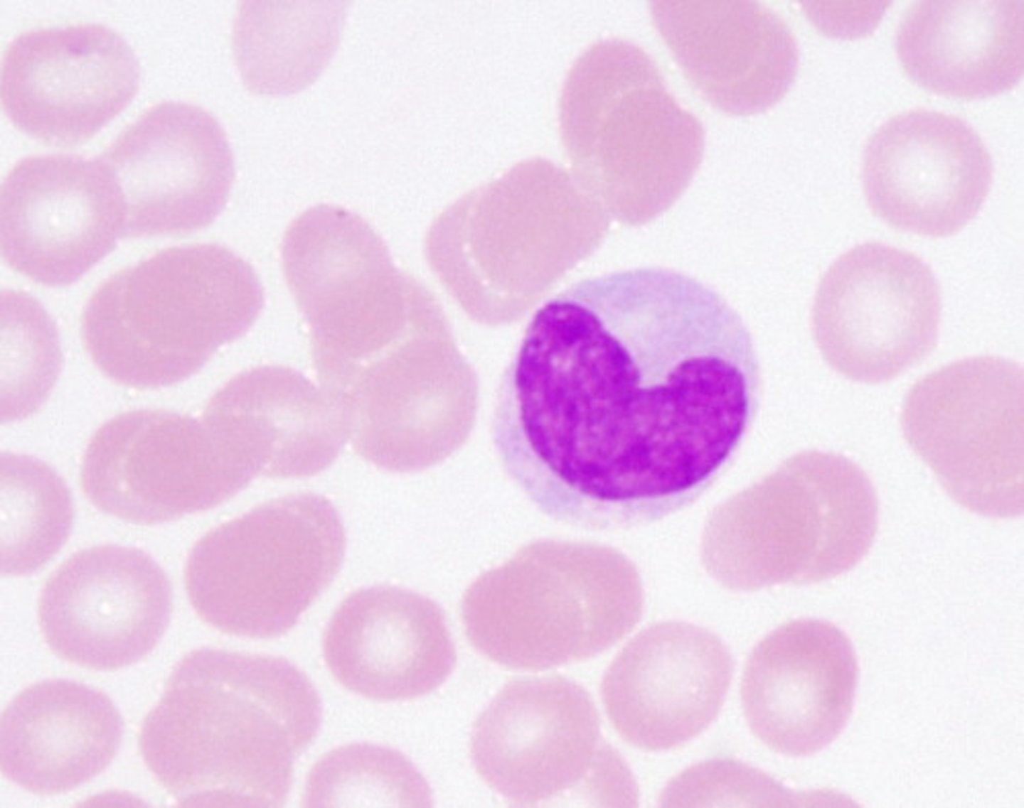 <p>Where red blood cells appear as small, round, pale-pink discs, white blood cells are larger with dark-stained nuclei, and platelets are tiny fragments scattered throughout.</p>