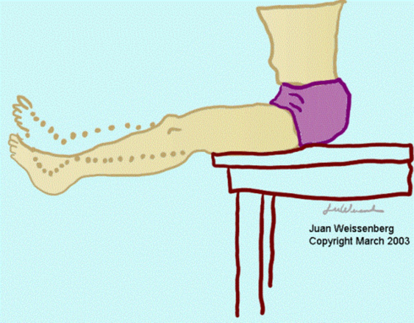 <p>Patient seated. Doctor stabilizes thighs and patient attempts to extend both legs.</p><p>Positive: pain or leaning back -> Disc (posteromedial disc IF pain when good leg is raised)</p>