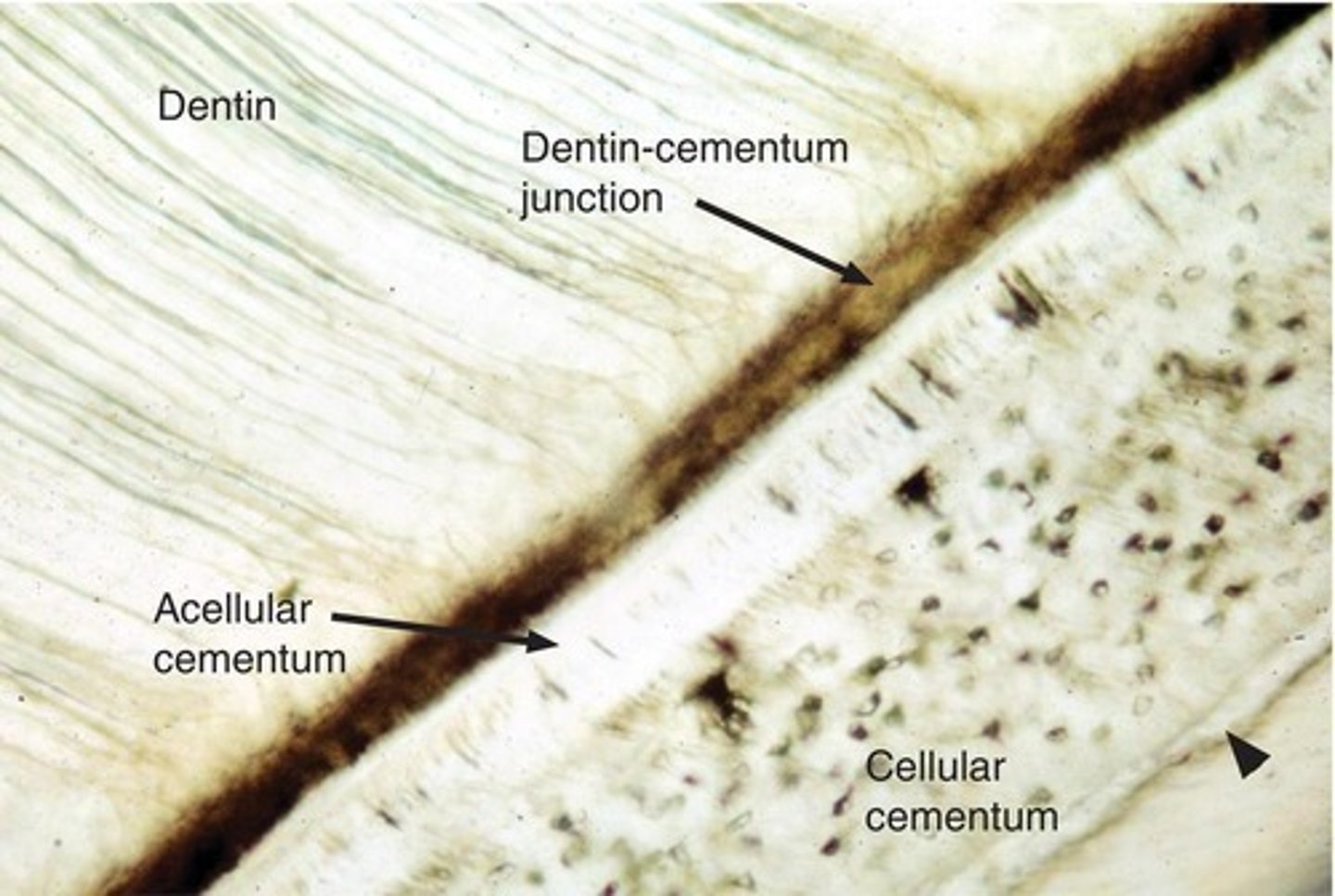 <p>Cells of the dental papilla change into odontoblasts, which secrete matrix and calcify to form dentin next to the epithelial root sheath.</p>