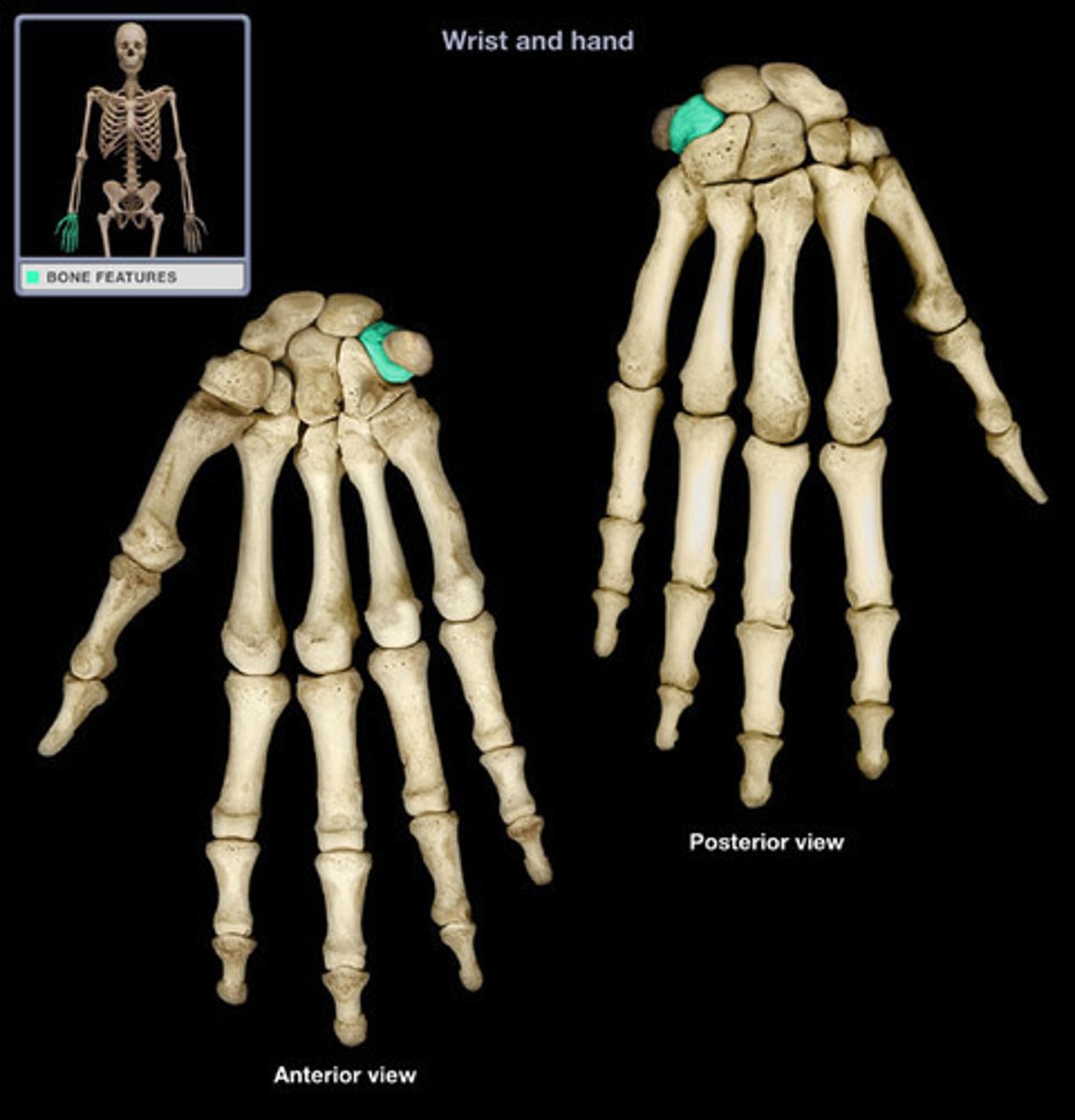 <p>What carpal is this?</p>