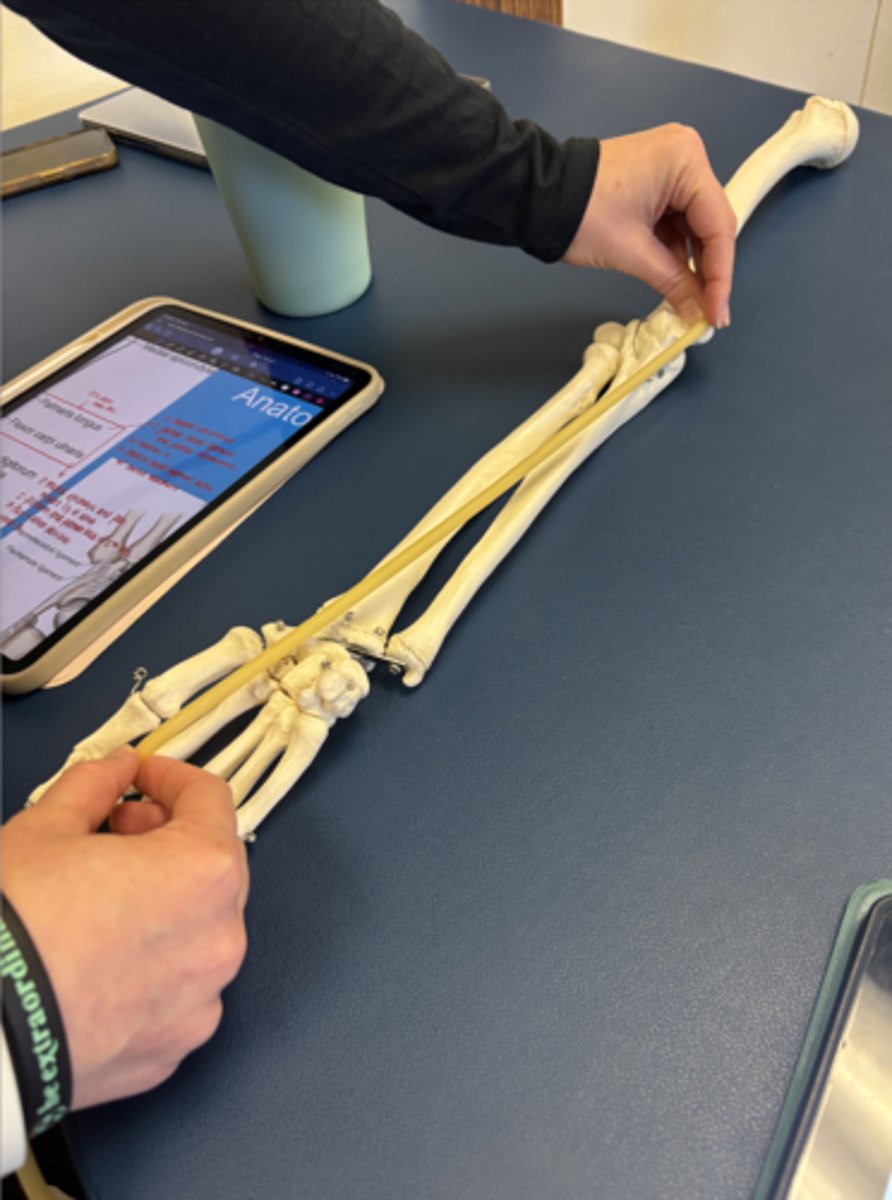 <p>What is this muscle?</p>