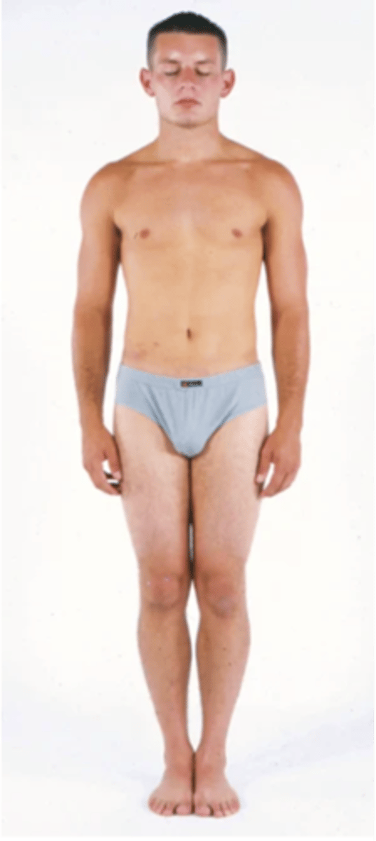 <p>A test that assesses a patient's coordination and equilibrium by making them stand straight for 20 seconds while their eyes are closed; a positive result means a loss of balance occurs</p>