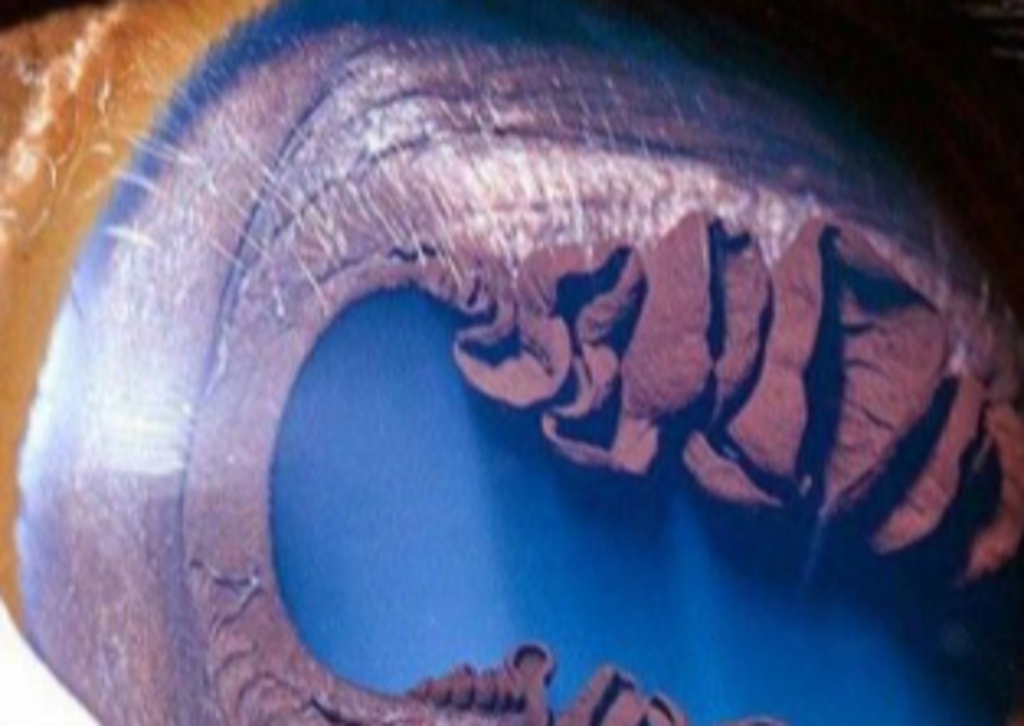 <p>What can happen to the iridic granules of the eye in bright light?</p>