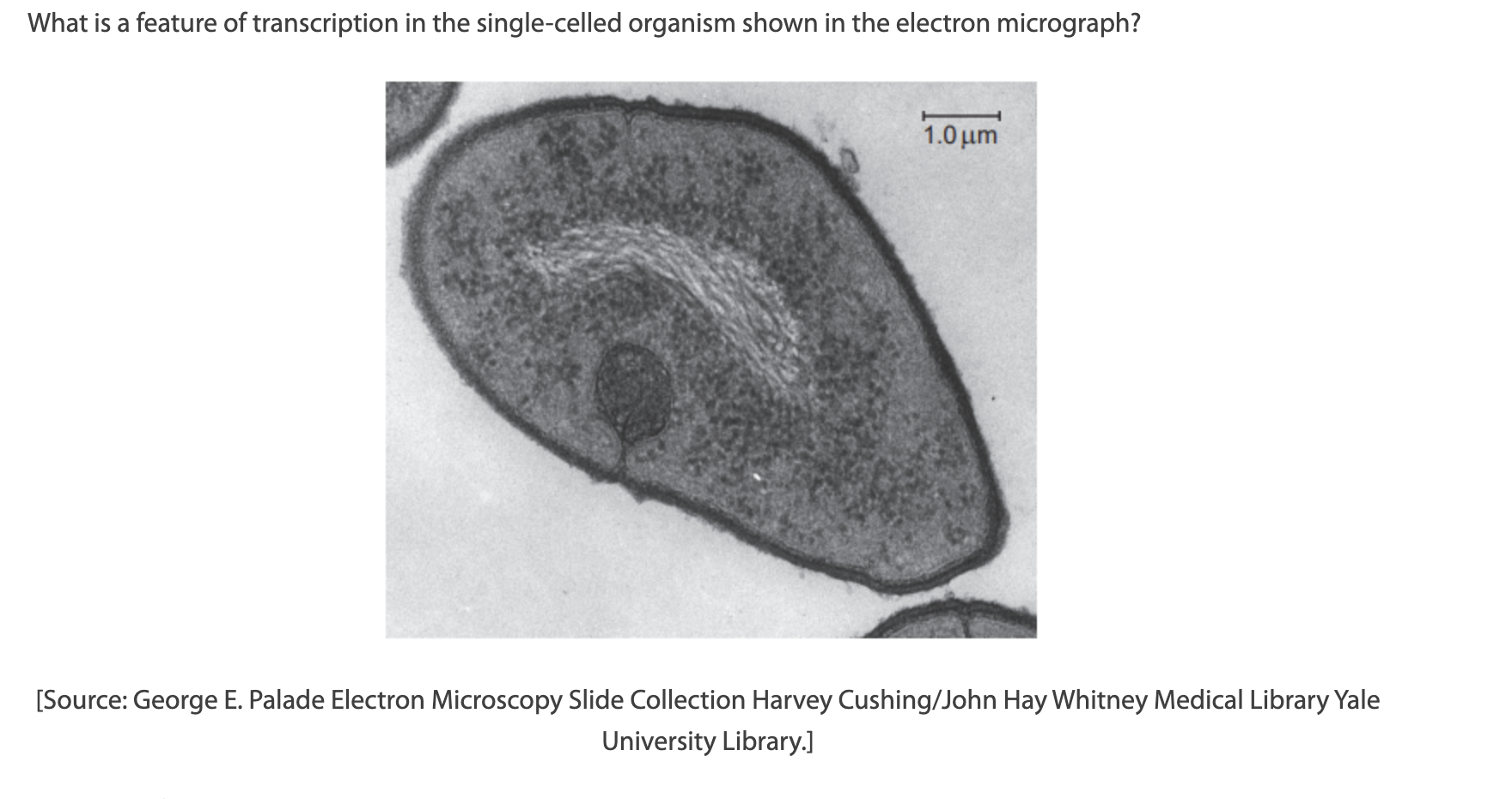 <p>A. mRNA splicing</p><p>B. Removal of introns</p><p>C. Codon-anticodon binding</p><p>D. Synthesis of RNA in a 5′ to 3′ direction</p>