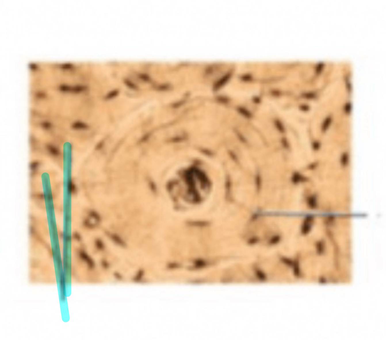 term image