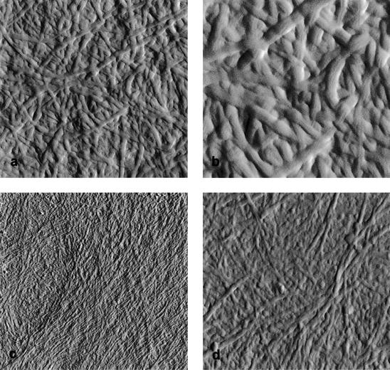 <p>A woven basket</p><p>Bundles of microfibrils are laid down in parallel and interwoven bands to form a structure similar to reinforced steel</p>