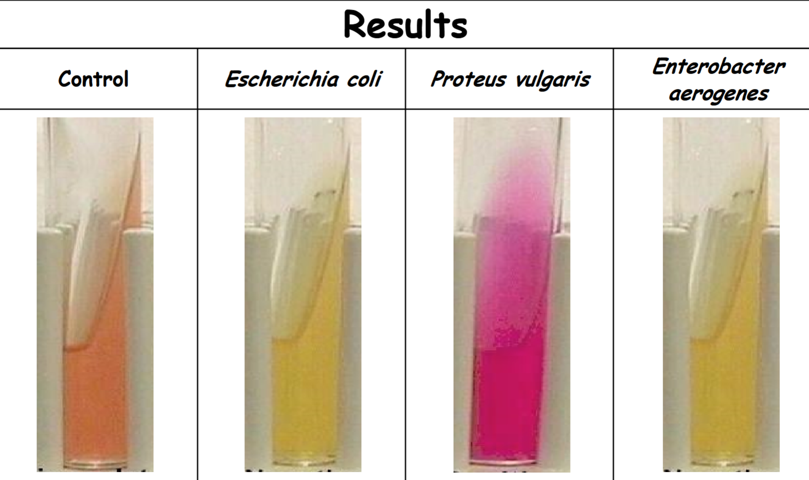 <p>Urea agar</p>