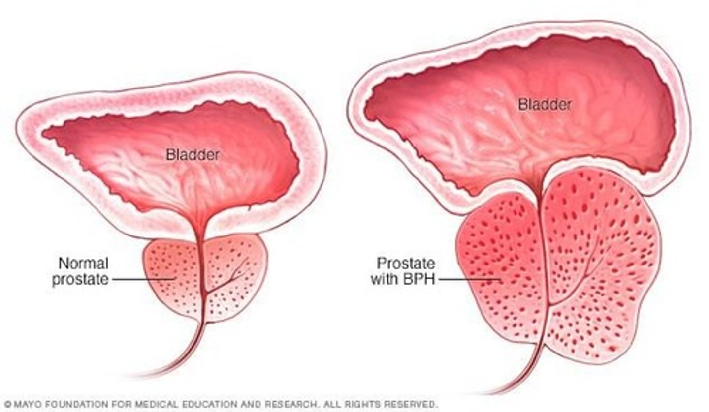 <p>It surrounds the urethra and ejaculatory duct, forming 30% of semen and enhancing sperm motility.</p>