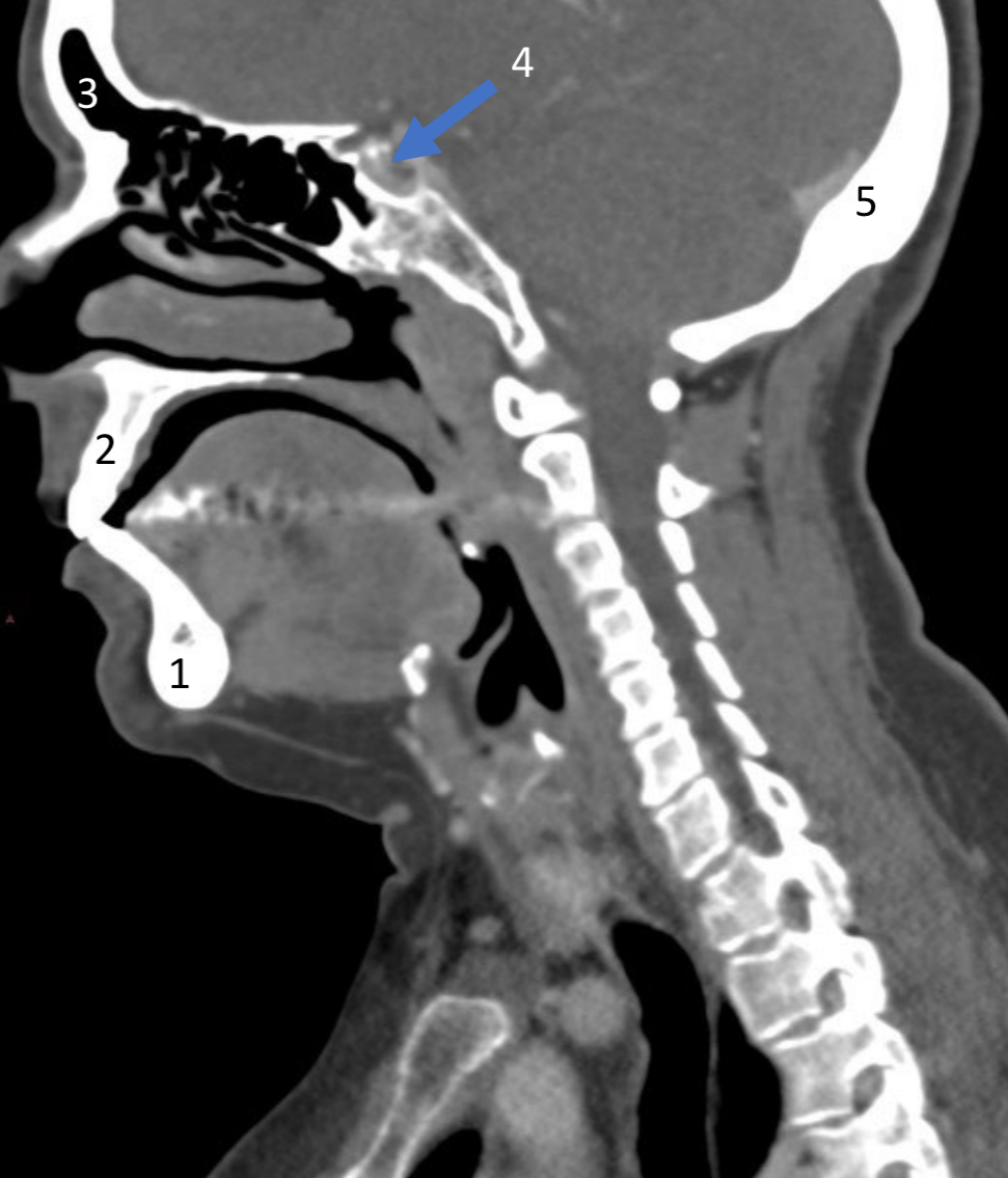 <ol start="4"><li><p>ID structure</p></li></ol><p></p>