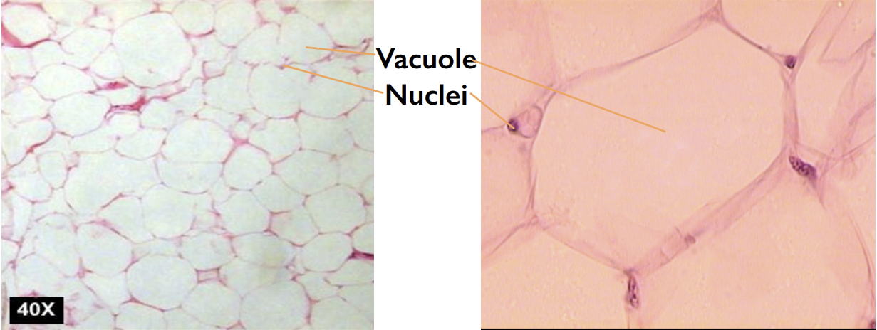 <p>Tissue located under the skin and around the kidneys; functions include energy storage and insulation.</p>