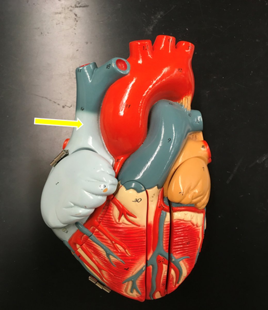 <p>* UPDATED PICTURE*</p>