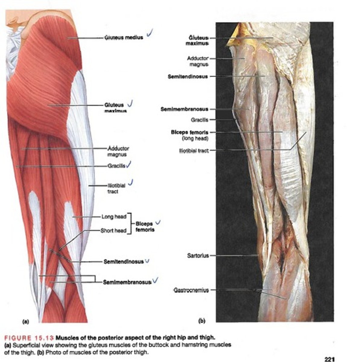 <p>Gluteus maximus, gluteus medius, biceps femoris, semitendinosus, and semimembranosus</p>