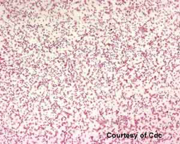 <p>Illustration of a Gram-negative, oxidase negative organism on chocolate agar at 72 hours with no growth on MacConkey agar. It is most likely to be:</p>