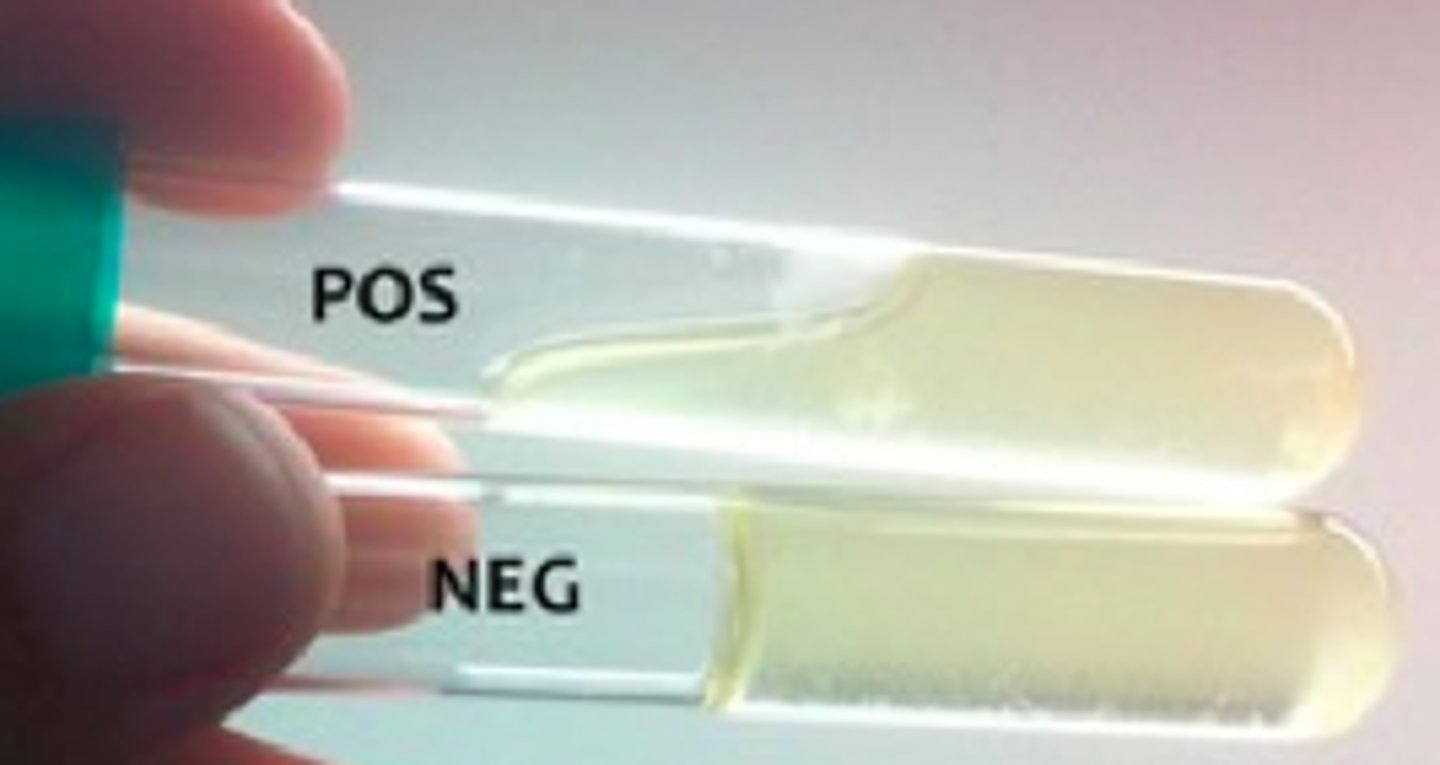 <p>Gelatin remained solid</p>