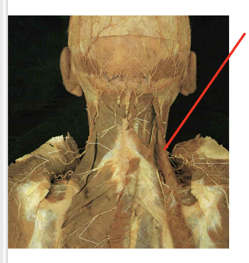<p>what is this muscle. What is its origin. Where does it inserts. </p>