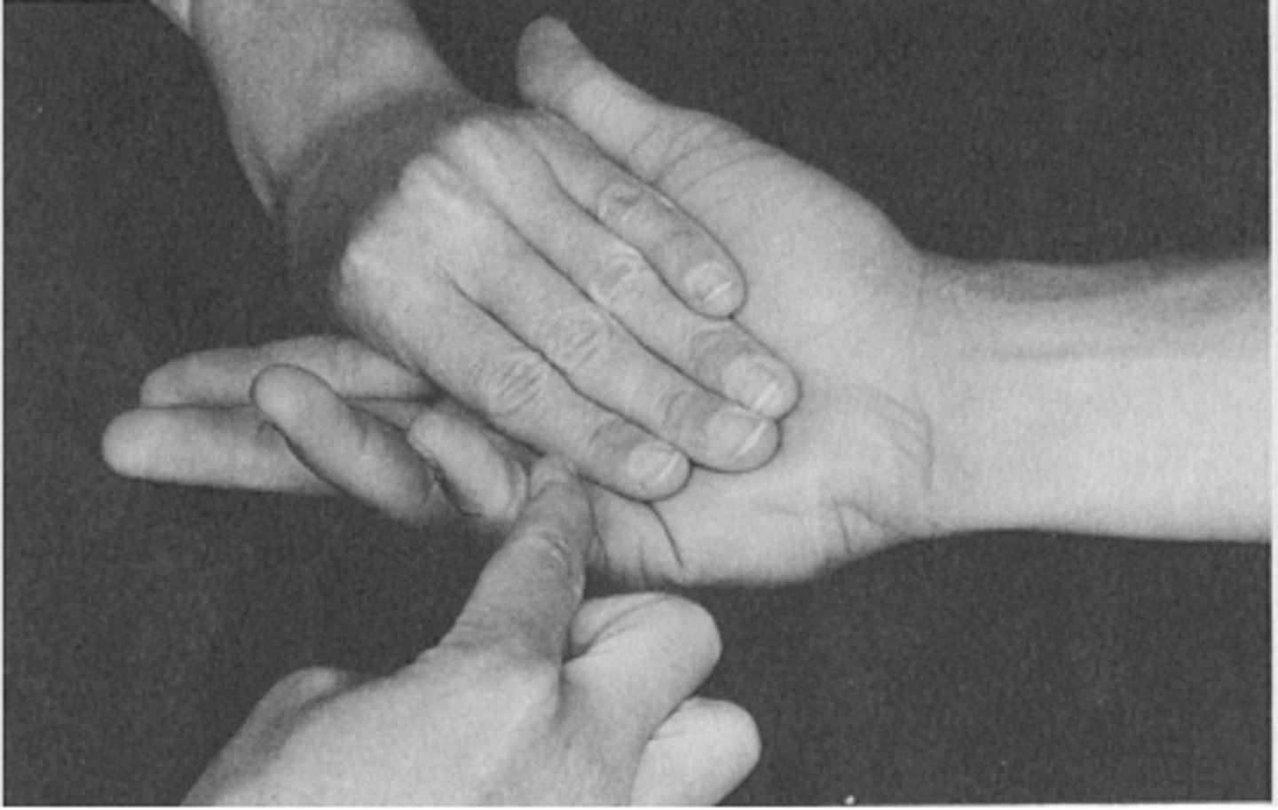 <p>V. MCP-t flektálja</p><p>Stabilizálás: tenyér</p><p>Csak az MCP-t hajlítsa, többi maradjon nyújtva</p><p>Ellenállás: proximalis phalanx volaris oldalán</p>