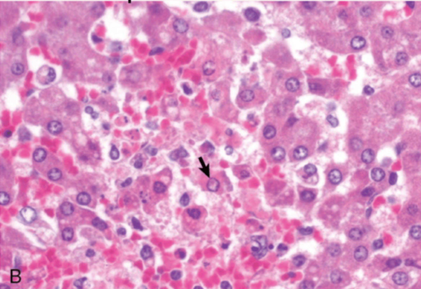 <p>hígado.</p><p>¿diagnóstico morfológico y etiológico?</p>
