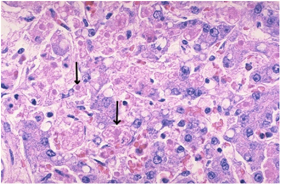 <ol><li><p>Identify the type of cell death</p></li><li><p>What cellular process is occurring?</p></li><li><p>What enzymes are involved?</p></li></ol><p></p>