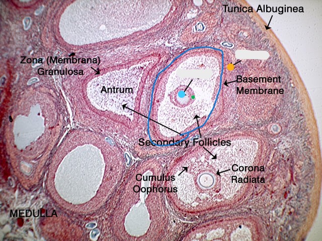 <p>what is this a slide of?</p>