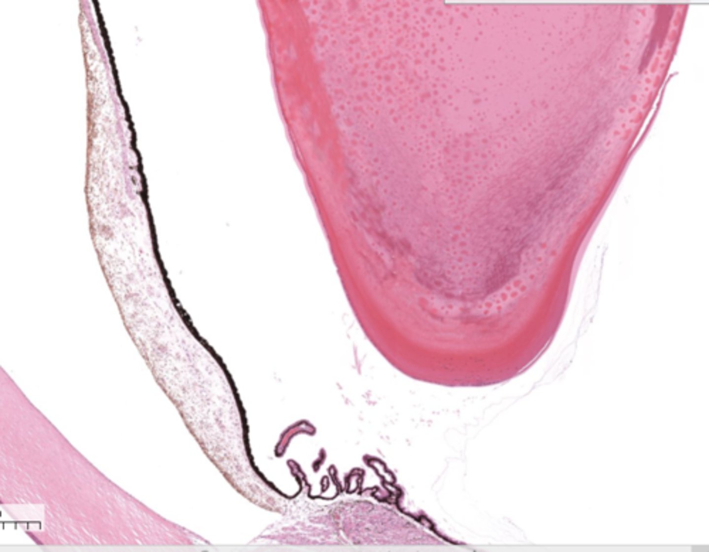 <p>the big pink thing</p>