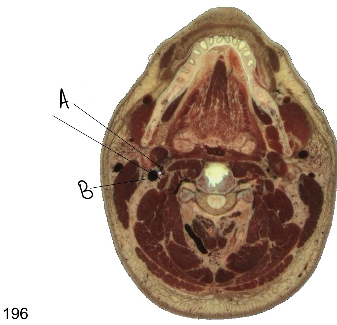 <p>what structure is labeled B?</p>