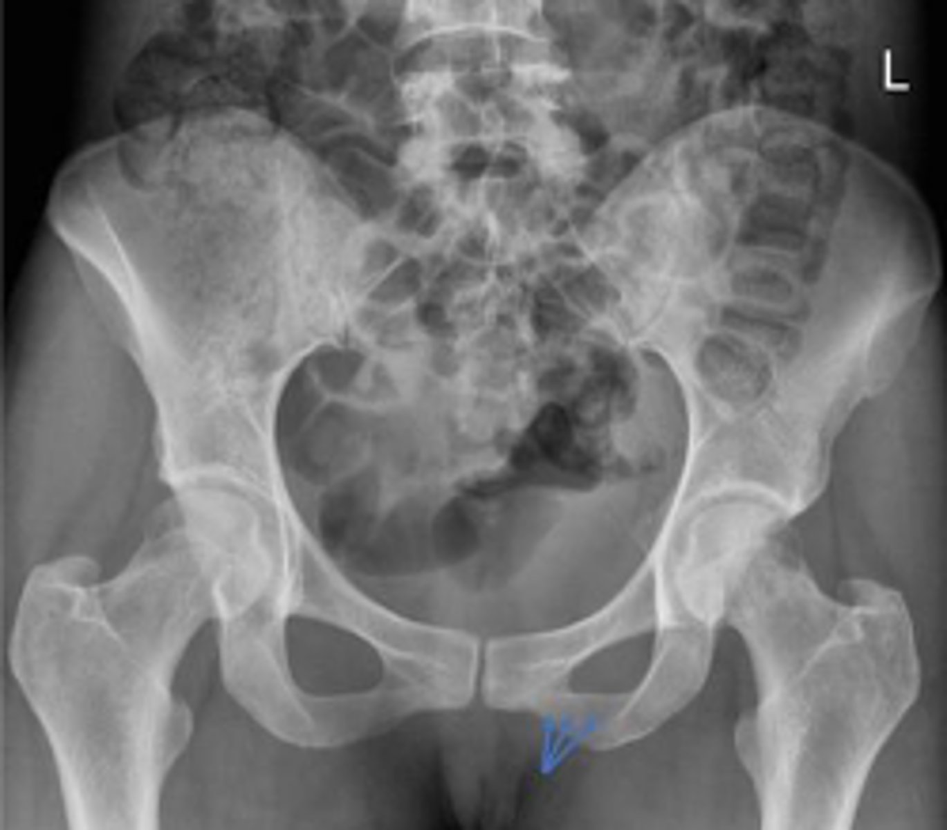 <p>What are the arrows pointing to?</p>