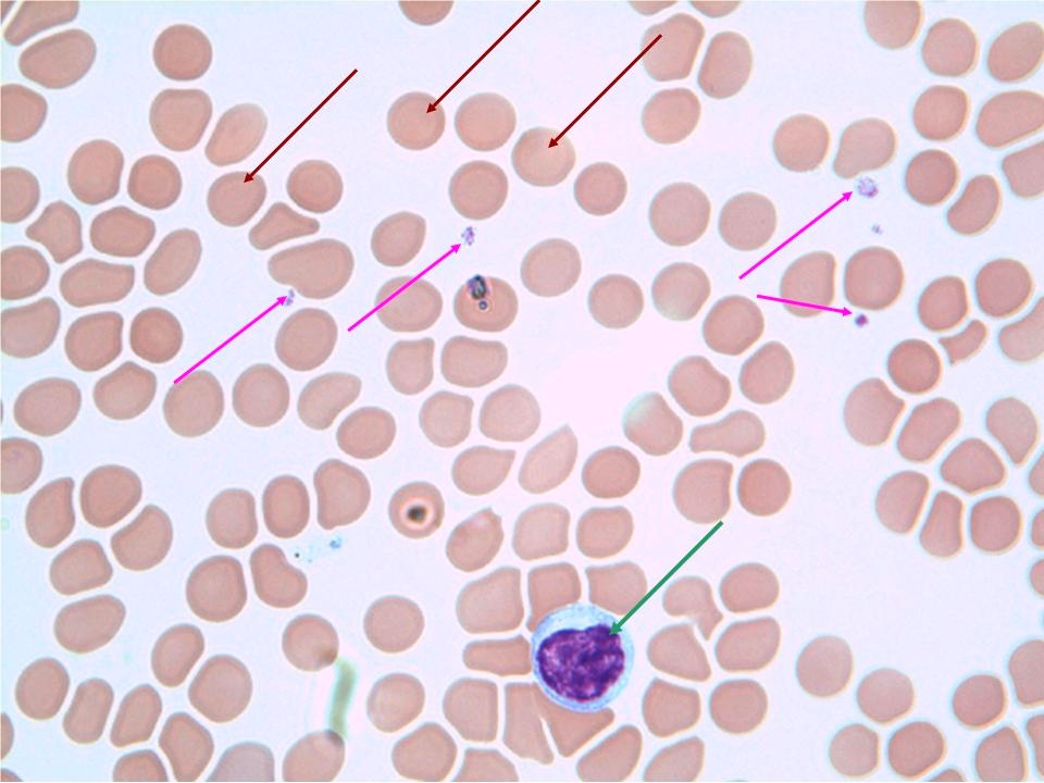 <p>Connective tissue: blood</p>